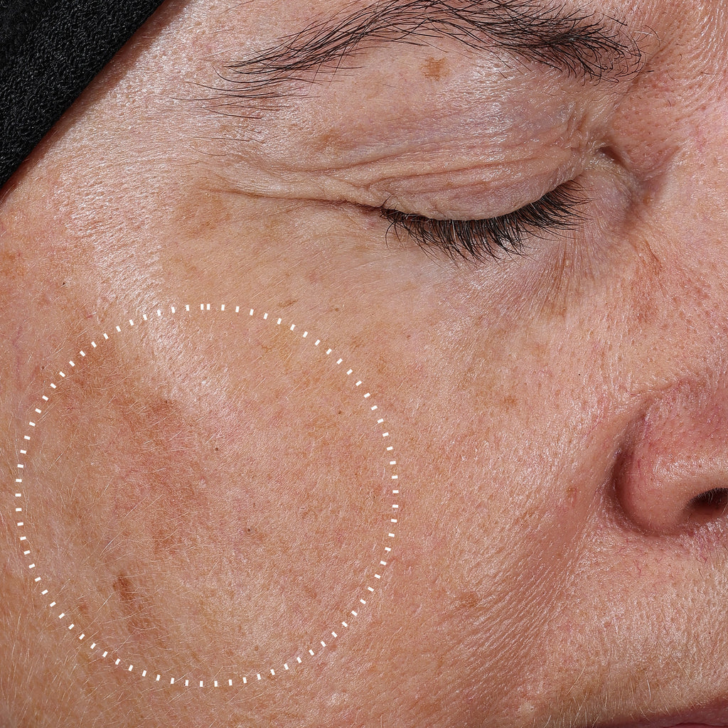 Potent 15% L-Ascorbic Acid | Brightening | Antioxidant Protection