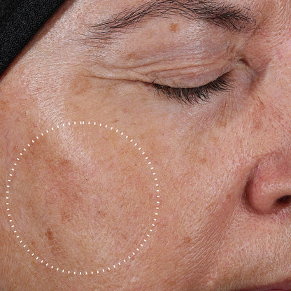 Potent 15% L-Ascorbic Acid | Brightening | Antioxidant Protection