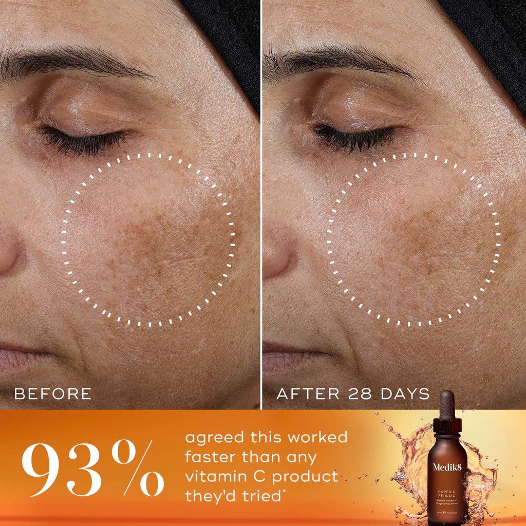 Potent 15% L-Ascorbic Acid | Brightening | Antioxidant Protection