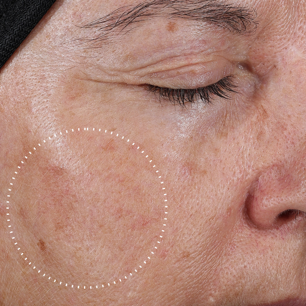 Potent 15% L-Ascorbic Acid | Brightening | Antioxidant Protection