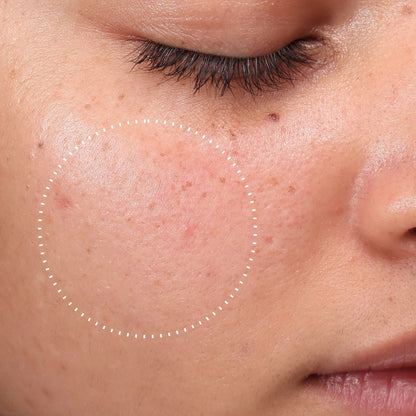 Medik8 Press & Clear 150ml