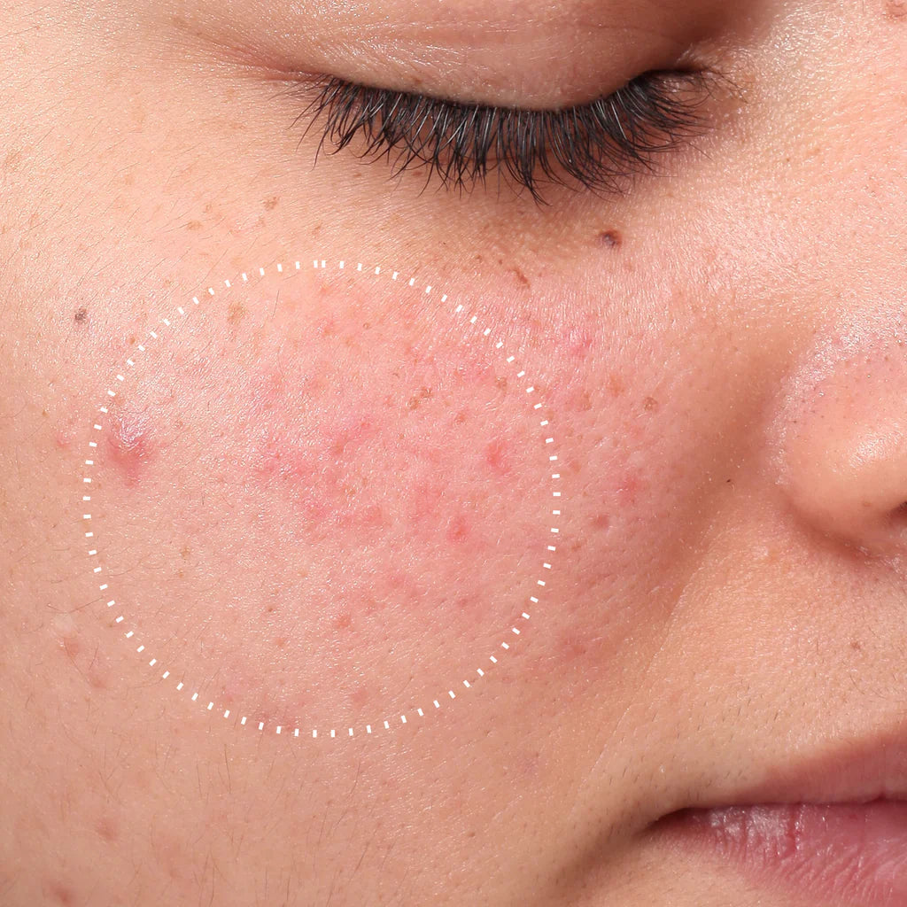 Medik8 Press & Clear 150ml